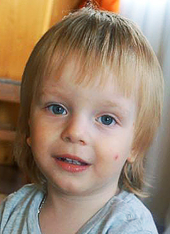 Dima Kaplin, 2 years old, cholesteatoma (tumor formation), microtia and atresia (hypoplasia) of the right ear canal, needs surgery at the California Ear Institute (Palo Alto, USA), course treatment required, <nobr>8,750.00 USD</nobr>